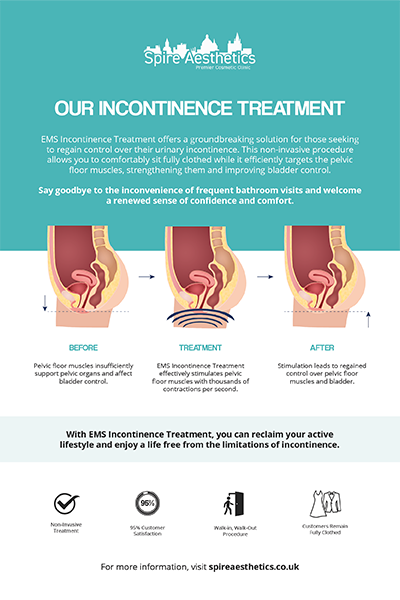 image to show how EMS treatment works for female urinary incontinence Sunbury Common