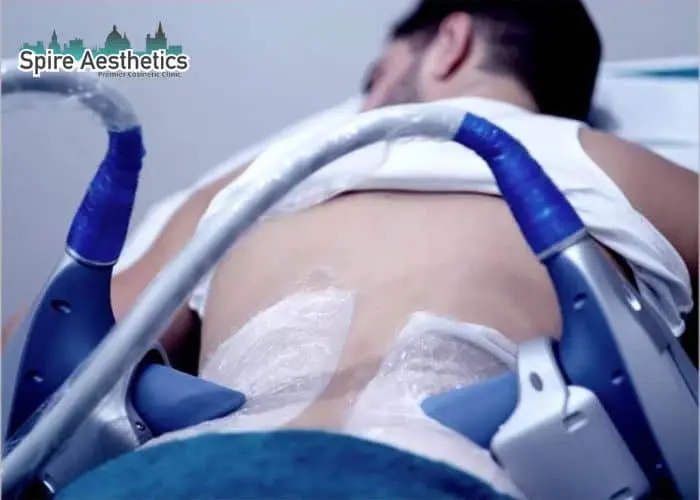 Man having fat freezing treatment done on love handles before a competitions Sunbury Common to create a sculpted look.