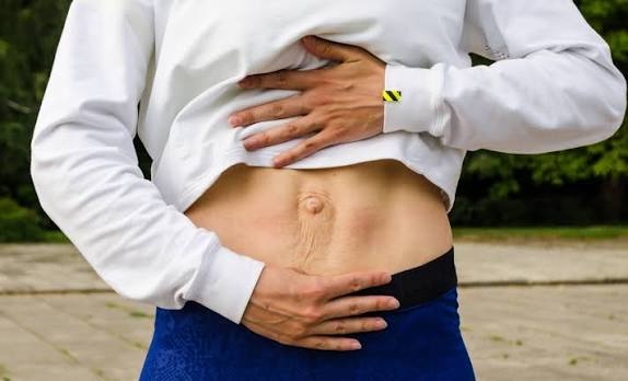 When Could Diastasis Recti Be the Missing Piece of the Puzzle Sunbury Common?